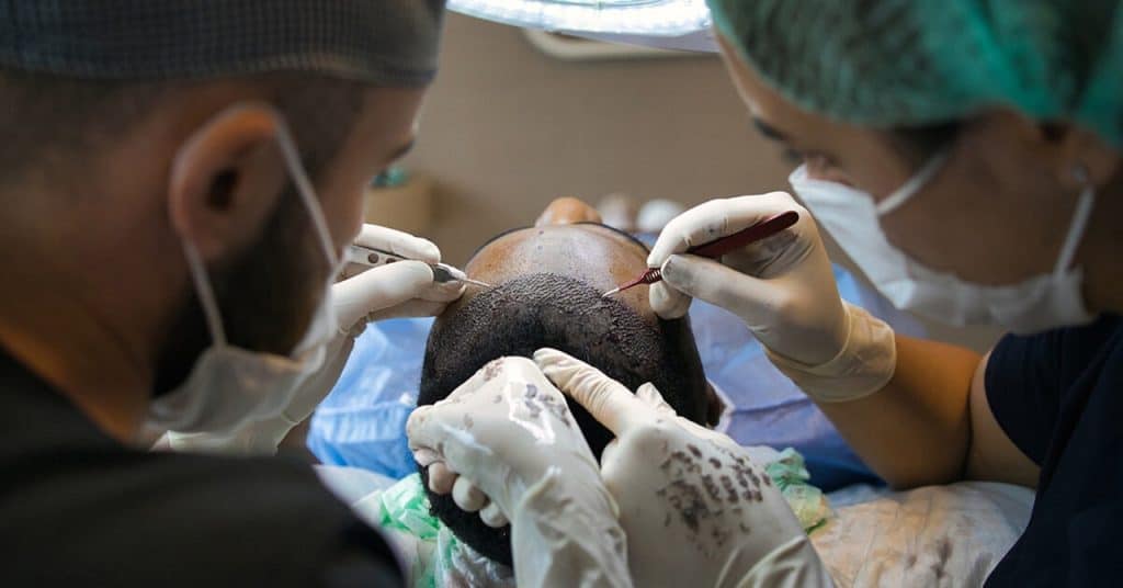 Afro Type Hair Transplant