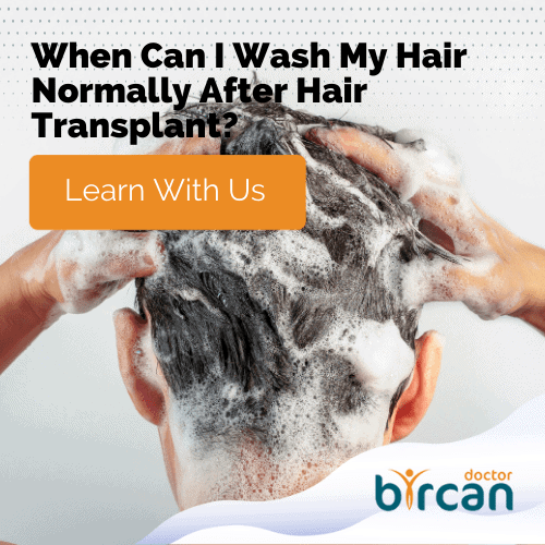 How Soon Can I Wash My Hair After The Hair Transplant Surgery?