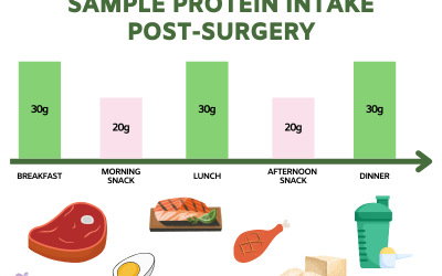 Are There Any Specific Dietary Restrictions I Should Follow Post-surgery?