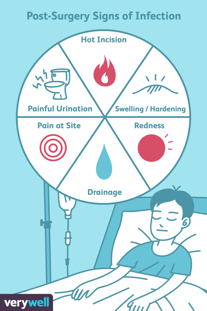 What Signs Of Infection Should I Watch Out For Post-surgery?