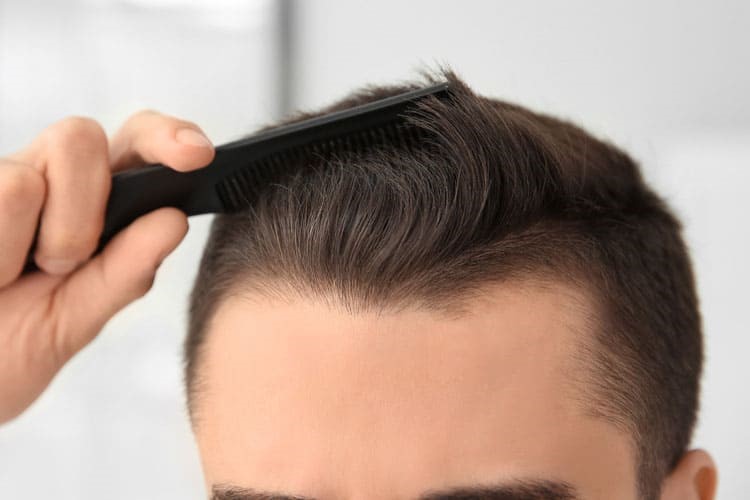 Will A Hair Transplant Look Natural?