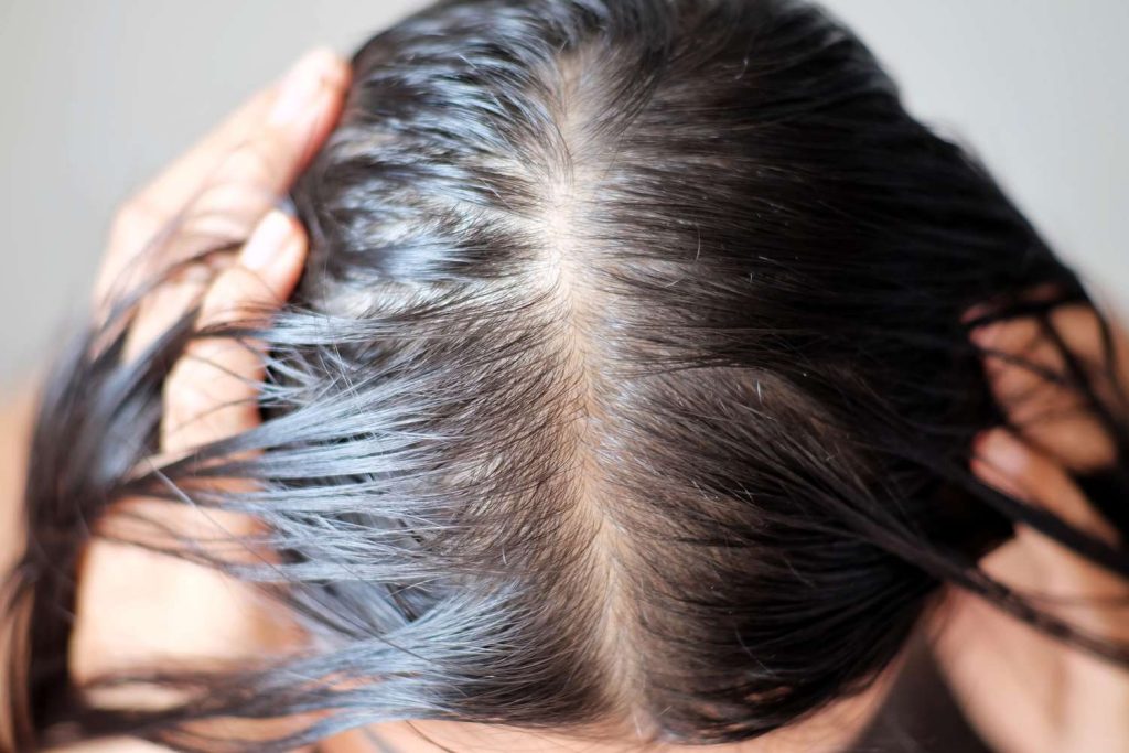 Is It Normal To Experience Numbness Or Tingling In The Scalp After The Procedure?