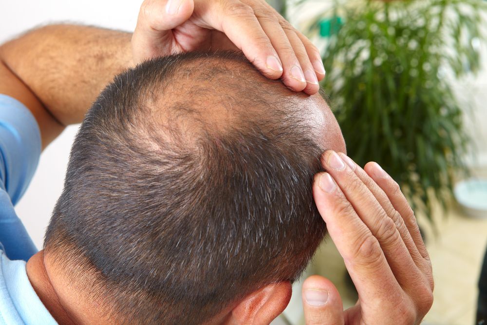 Is It Normal To Experience Numbness Or Tingling In The Scalp After The Procedure?